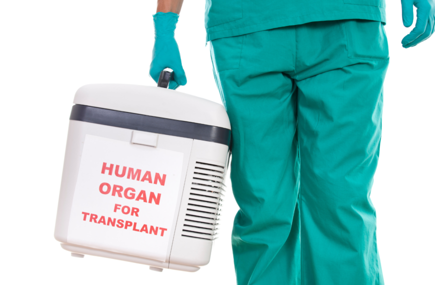 Identifying best Cryopreservation strategy for Organ transplantation