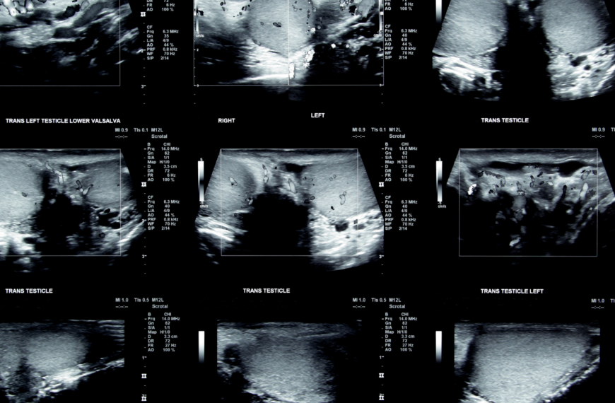 Using Organoids to study testicular functions